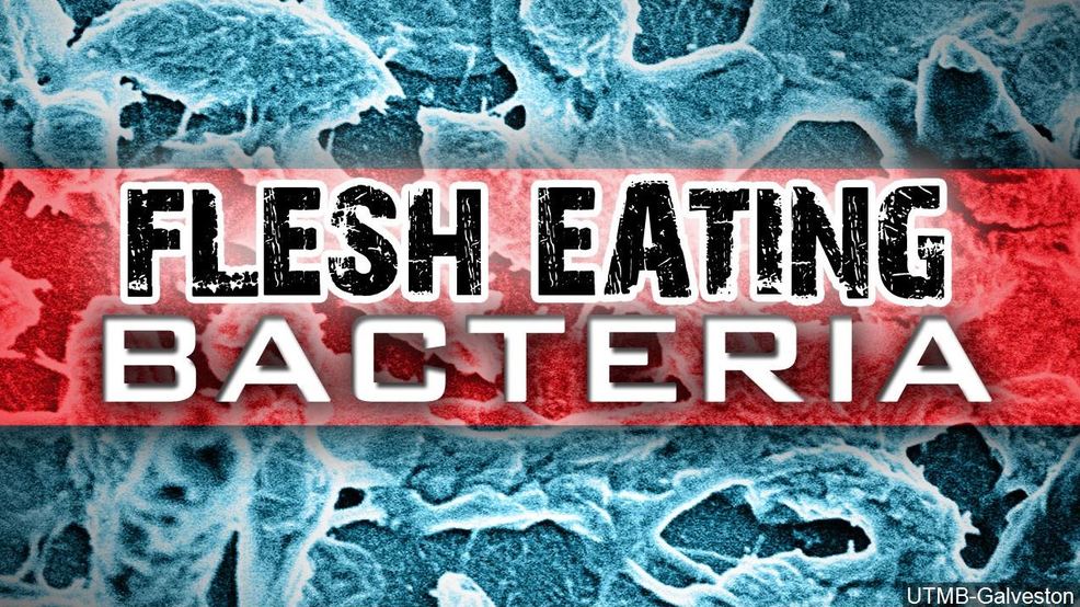 Flesh-eating Bacteria Kills Florida Woman | WPEC