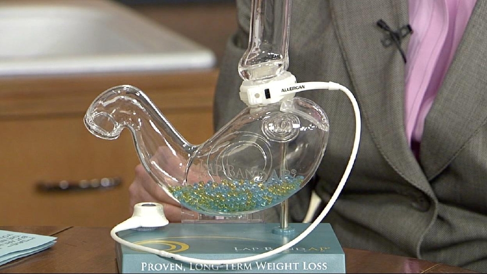 042612weightloss.jpg_BIM.jpg