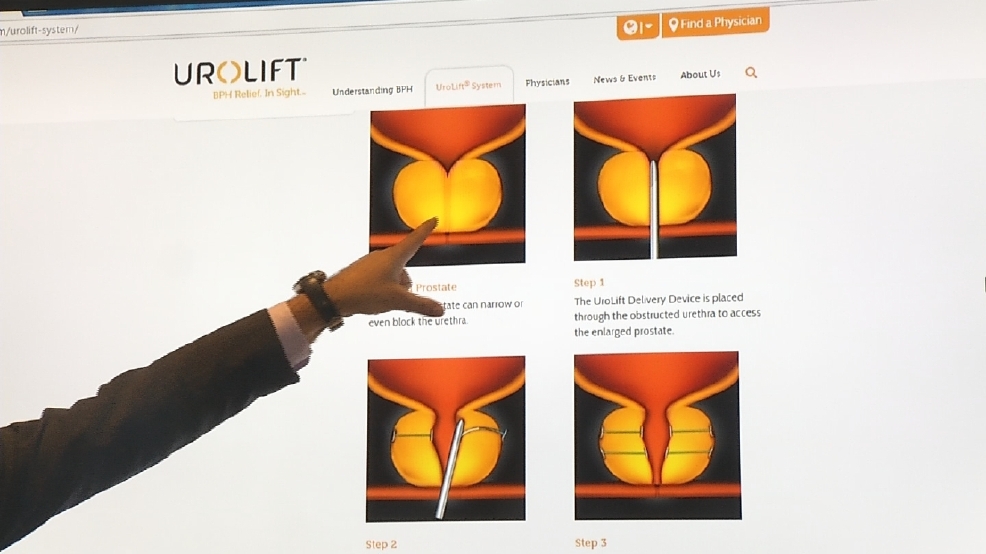 Health Check Urolift prostate treatment WJAR